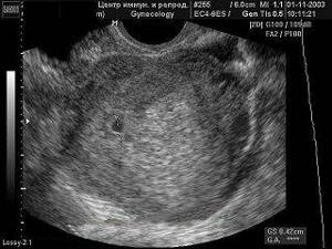 первые дни беременности фото